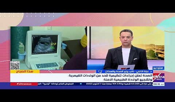 تسجيل أعلى معدلات ولادة قيصرية في العالم