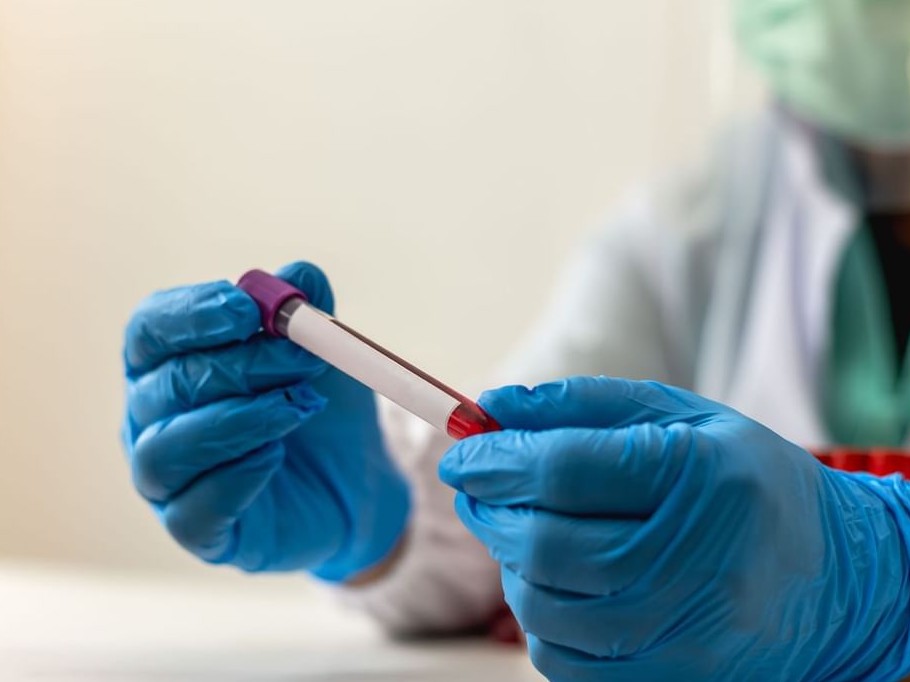 مركب فطري واعد ضد السرطان