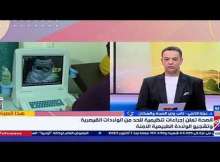 تسجيل أعلى معدلات ولادة قيصرية في العالم