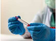 مركب فطري واعد ضد السرطان