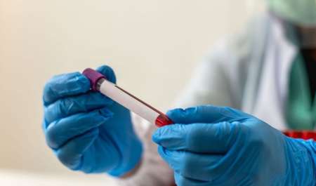 علماء ينجحون في تصنيع مركب فطري واعد ضد السرطان