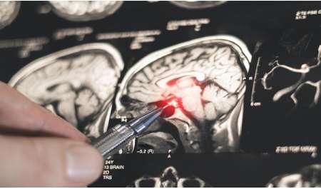 اكتشاف روسي جديد يفتح الطريق لتطوير أدوية لعلاج باركنسون  